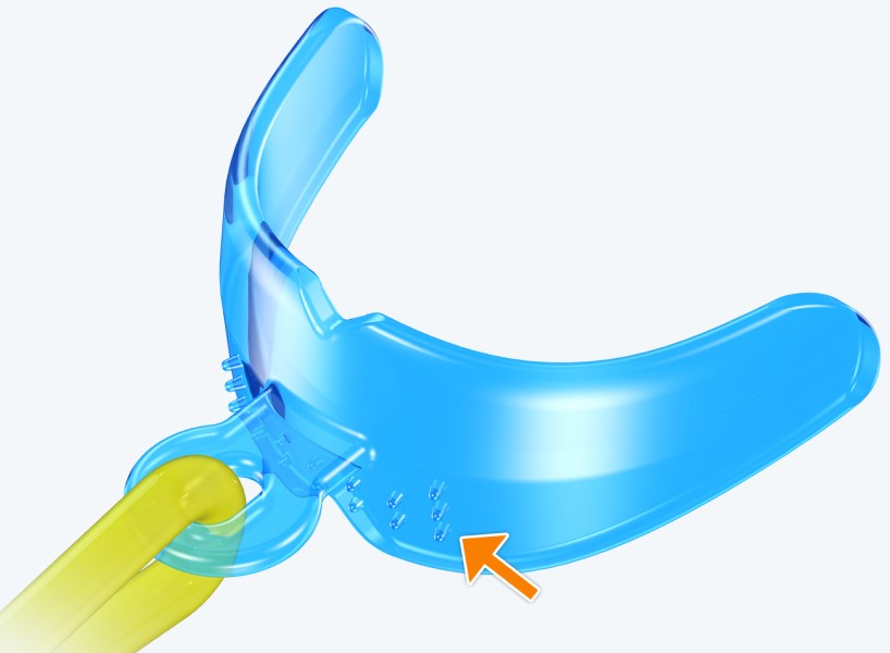 Lip Trainer™ Myotalea® | MYOBRACE