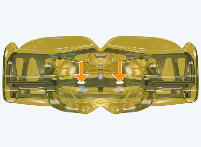 i-3 MyoBrace | From 5 to 12 Years Old | Orthodontic Appliance