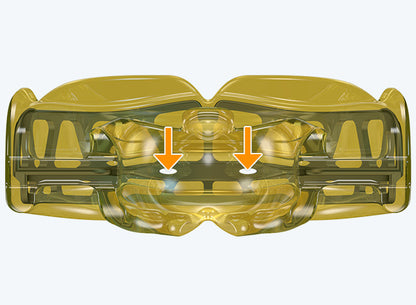 i-3 MyoBrace | From 5 to 12 Years Old | Orthodontic Appliance