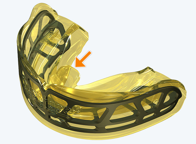 i-3 MyoBrace | From 5 to 12 Years Old | Orthodontic Appliance