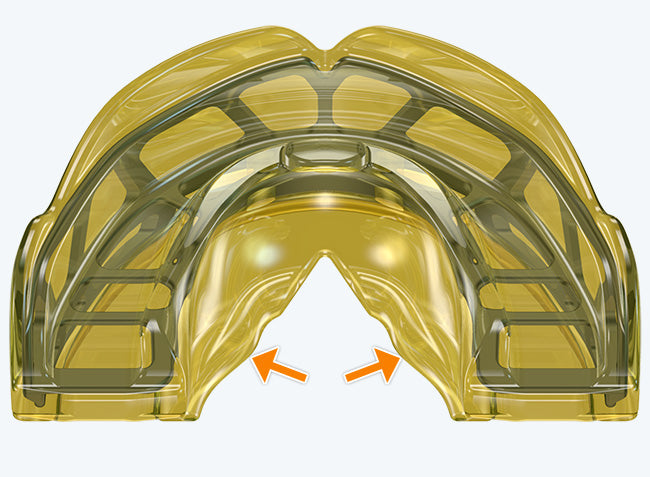 i-3 MyoBrace | From 5 to 12 Years Old | Orthodontic Appliance