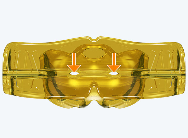 i-3H MyoBrace | From 5 to 12 Years Old | Orthodontic Appliance