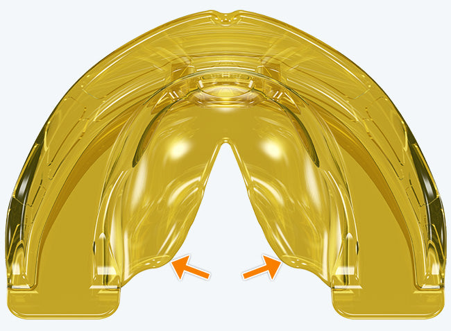 i-3H MyoBrace | From 5 to 12 Years Old | Orthodontic Appliance