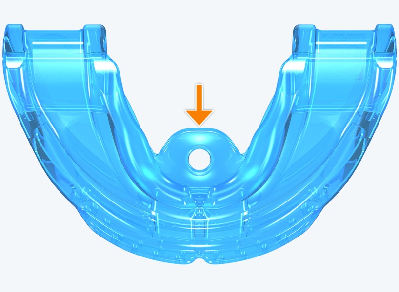 J1 MyoBrace® Junior | MYOBRACE