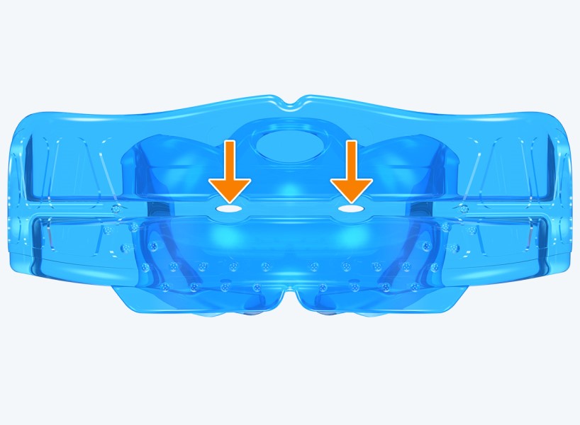 J2 MyoBrace® Junior | MYOBRACE