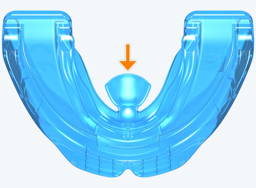 K0 MyoBrace® Niños | MYOBRACE