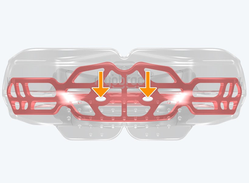 K2 Broad MyoBrace® Kids | MYOBRACE