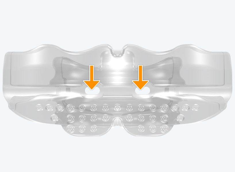 T1 MyoBrace® Teens | MYOBRACE