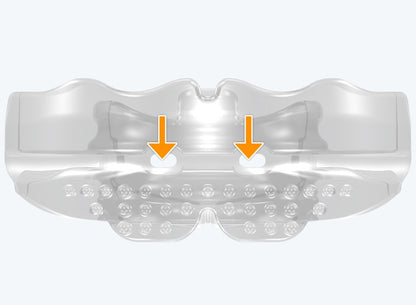 T1 MyoBrace® Teens | MYOBRACE