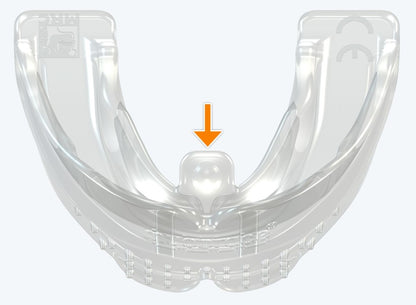 T1 MyoBrace® Teens | MYOBRACE