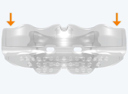 T1 BWS MyoBrace® Adolescentes | MYOBRACE