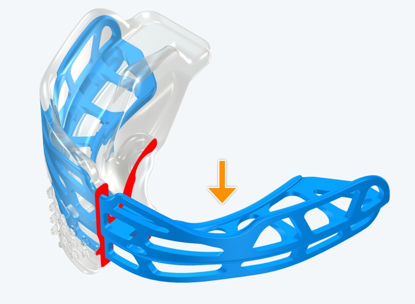 T2 MyoBrace Teens | From 10 to 15 years old | Myofunctional Appliance for Oral Habits Correction and Teeth Alignment