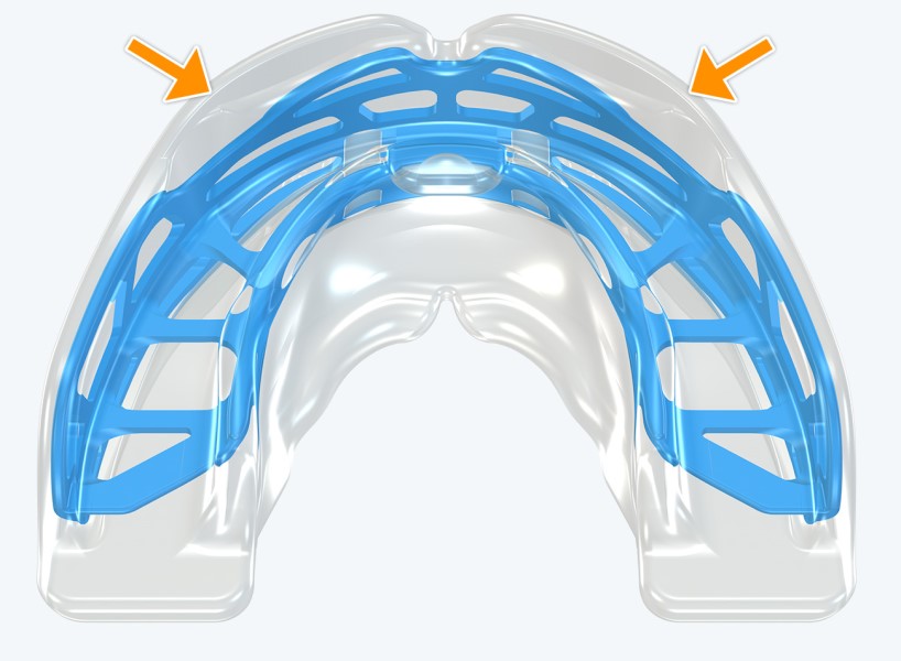 T2 MyoBrace® Adolescentes | MYOBRACE