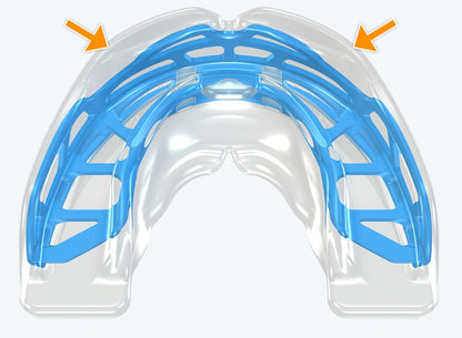 T2 MyoBrace Teens | From 10 to 15 years old | Myofunctional Appliance for Oral Habits Correction and Teeth Alignment