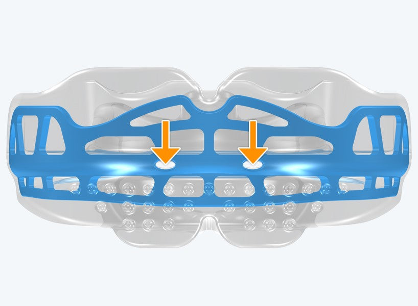 T2 MyoBrace® Adolescentes | MYOBRACE