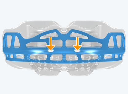 T2 MyoBrace Teens | From 10 to 15 years old | Myofunctional Appliance for Oral Habits Correction and Teeth Alignment