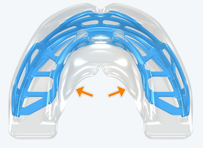 T2 MyoBrace Teens | From 10 to 15 years old | Myofunctional Appliance for Oral Habits Correction and Teeth Alignment