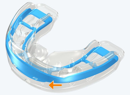 T3 MyoBrace® Adolescentes | MYOBRACE