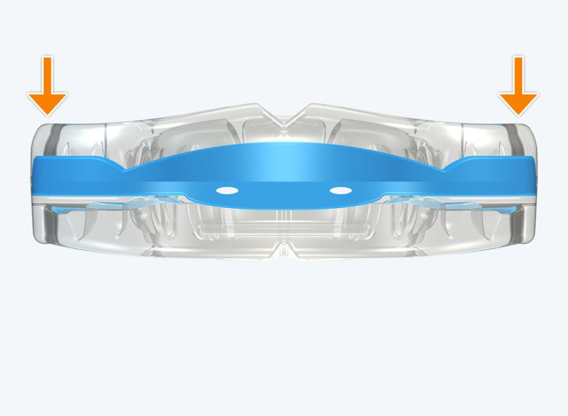 T3 MyoBrace® Adolescentes | MYOBRACE