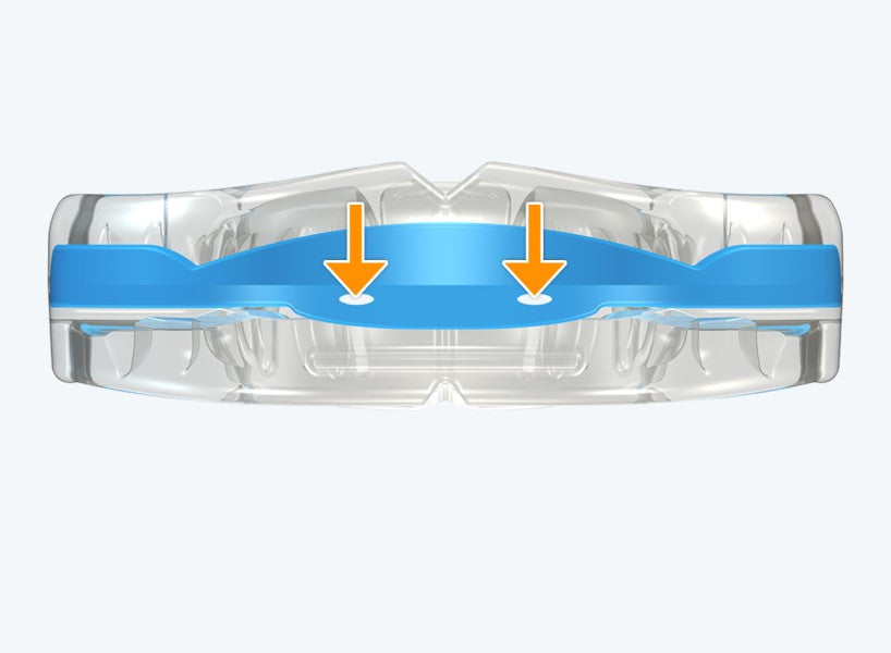 T3 MyoBrace® Adolescentes | MYOBRACE