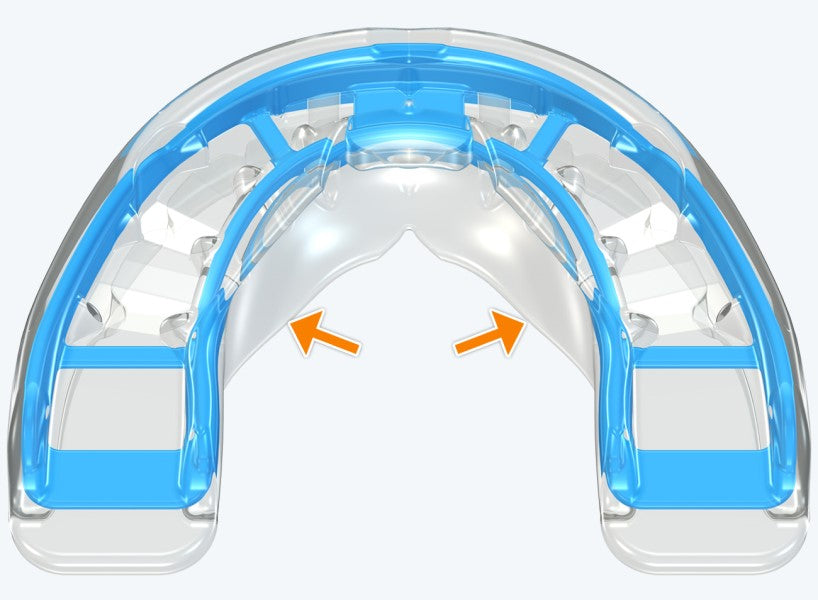 T3 MyoBrace® Adolescentes | MYOBRACE