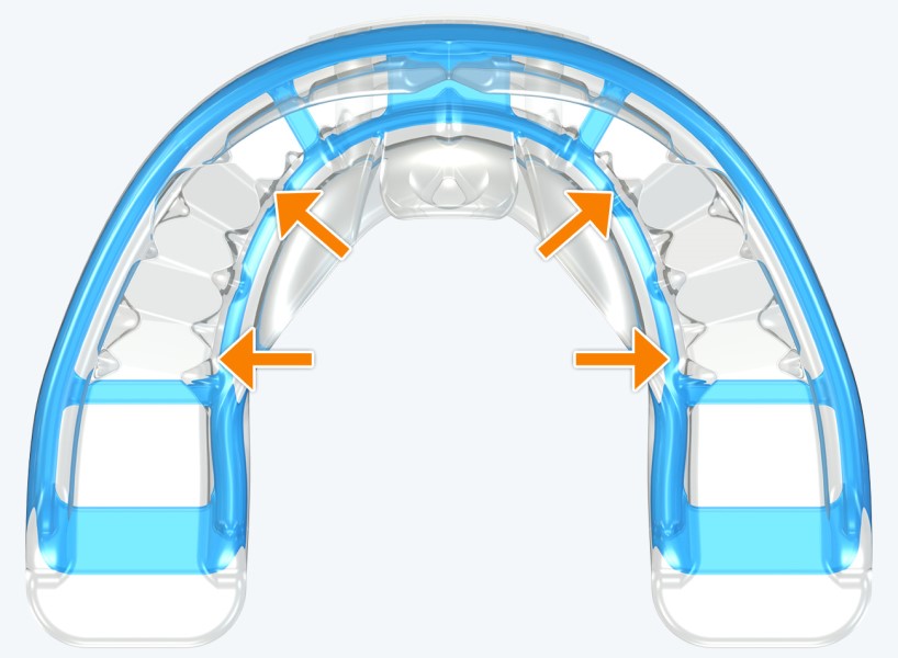 T3 MyoBrace® Adolescentes | MYOBRACE