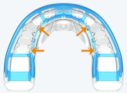 T3 MyoBrace® Teens | MYOBRACE