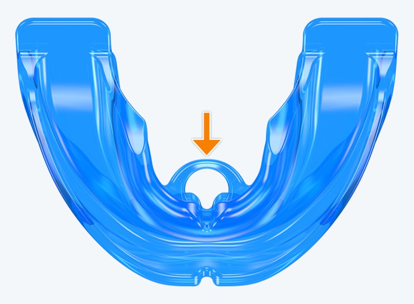 T4 MyoBrace® Adolescentes | MYOBRACE